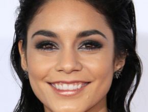 Vanessa Hudgens plastic surgery (18)