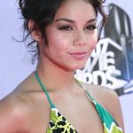 Vanessa Hudgens plastic surgery (24)