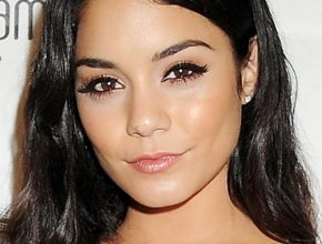 Vanessa Hudgens plastic surgery