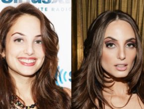 Alexa Ray Joel before and after plastic surgery