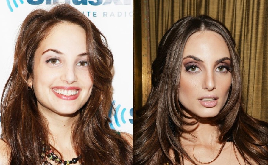 Alexa Ray Joel before and after plastic surgery 