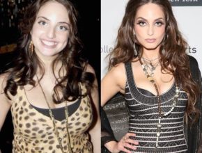 Alexa Ray Joel before and after plastic surgery (31)
