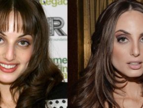 Alexa Ray Joel before and after plastic surgery (32)