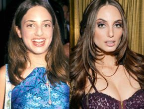 Alexa Ray Joel before and after plastic surgery (33)