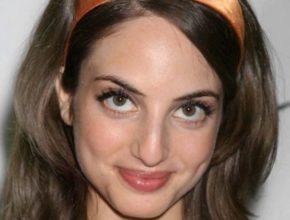 Alexa Ray Joel plastic surgery (42)