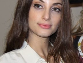 Alexa Ray Joel plastic surgery (9)