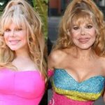 Charo before and after plastic surgery (11)