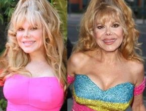 Charo before and after plastic surgery (11)