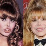 Charo before and after plastic surgery