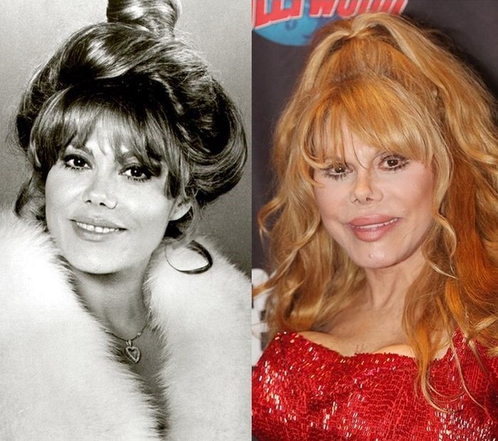 Charo before and after plastic surgery