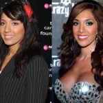 Farrah Abraham before and after plastic surgery (15)