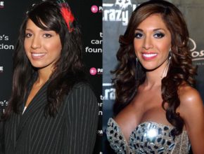 Farrah Abraham before and after plastic surgery (15)