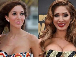 Farrah Abraham before and after plastic surgery (16)