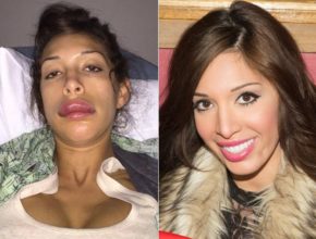 Farrah Abraham before and after plastic surgery