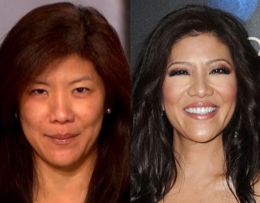 Julie Chen before and after plastic surgery