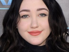 Noah Cyrus plastic surgery (01)