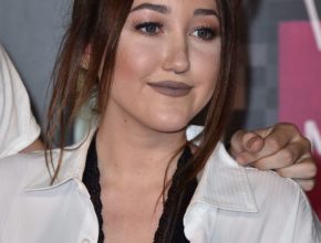 Noah Cyrus plastic surgery (1)