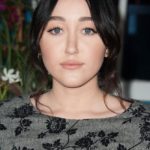 Noah Cyrus plastic surgery (15)