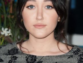 Noah Cyrus plastic surgery (15)