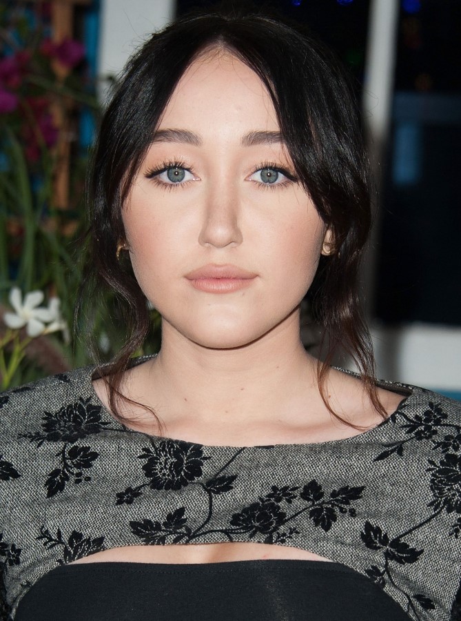 Noah Cyrus plastic surgery (15) .