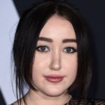 Noah Cyrus plastic surgery (21)