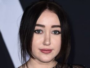 Noah Cyrus plastic surgery (21)