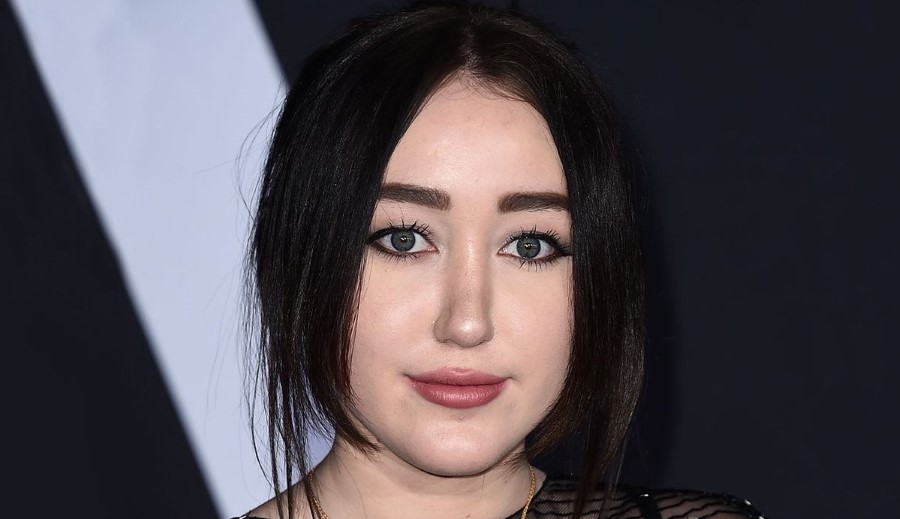 Noah Cyrus plastic surgery (21) .