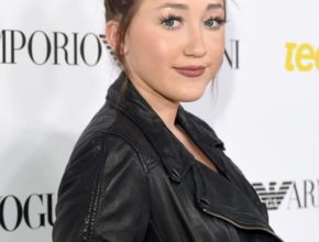 Noah Cyrus plastic surgery (22)