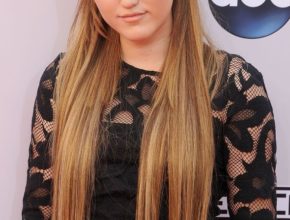 Noah Cyrus plastic surgery (23)