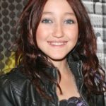 Noah Cyrus plastic surgery (27)