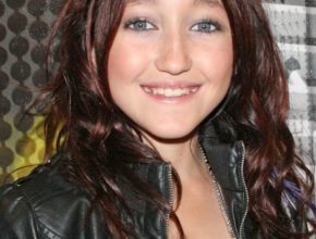 Noah Cyrus plastic surgery (27)