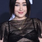 Noah Cyrus plastic surgery (31)