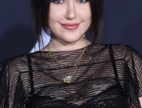 Noah Cyrus plastic surgery (31)