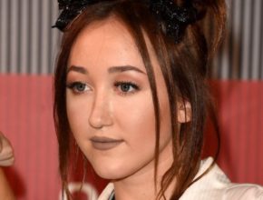 Noah Cyrus plastic surgery (4)