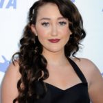 Noah Cyrus plastic surgery (7)