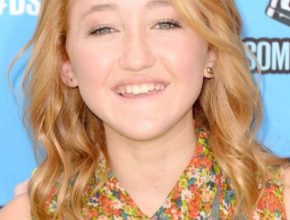 Noah Cyrus plastic surgery