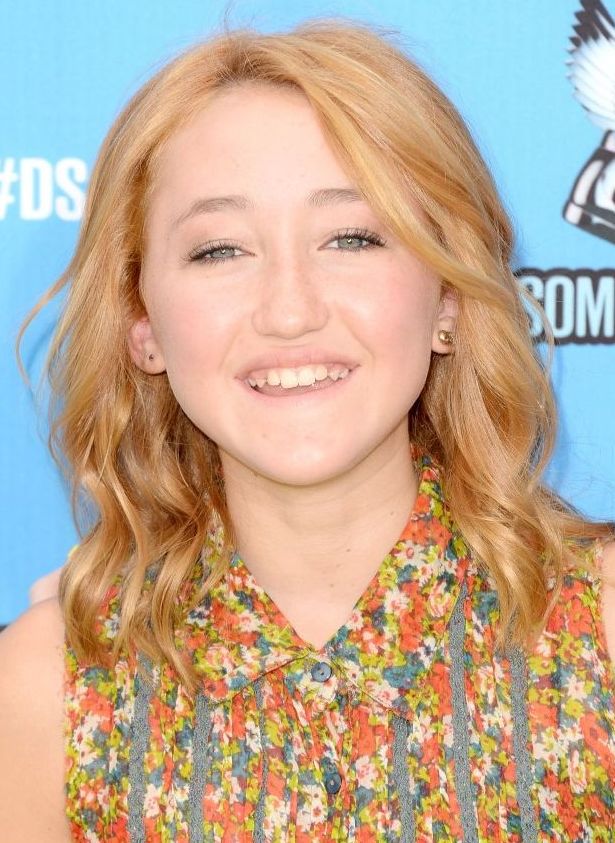 Noah Cyrus plastic surgery