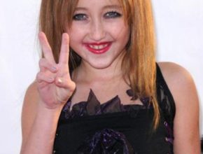 Noah Cyrus plastic surgery (9)