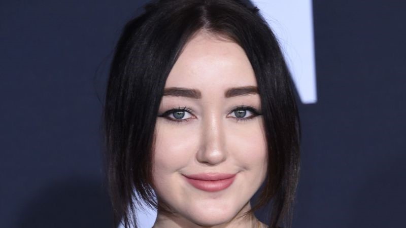 Noah Cyrus plastic surgery