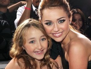 Noah and Miley Cyrus plastic surgery (28)