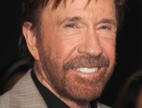 Chuck Norris plastic surgery (15)