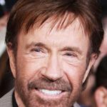 Chuck Norris plastic surgery (17)