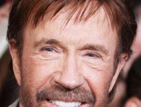 Chuck Norris plastic surgery (17)