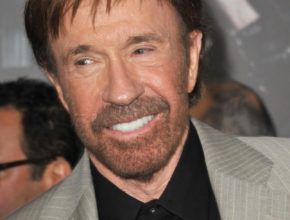 Chuck Norris plastic surgery (18)