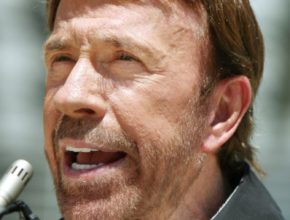 Chuck Norris plastic surgery (23)