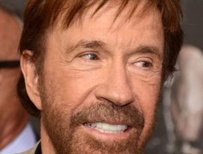 Chuck Norris plastic surgery