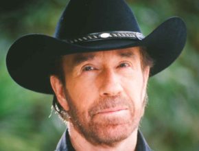 Chuck Norris plastic surgery (35)