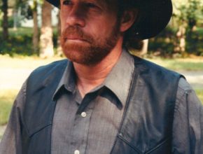 Chuck Norris plastic surgery (36)