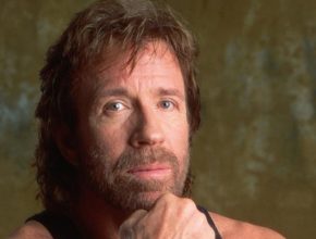 Chuck Norris plastic surgery (38)