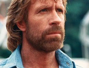 Chuck Norris plastic surgery (42)